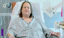 "ليزا" تفارق الحياة بعد زراعة كلية خنزير